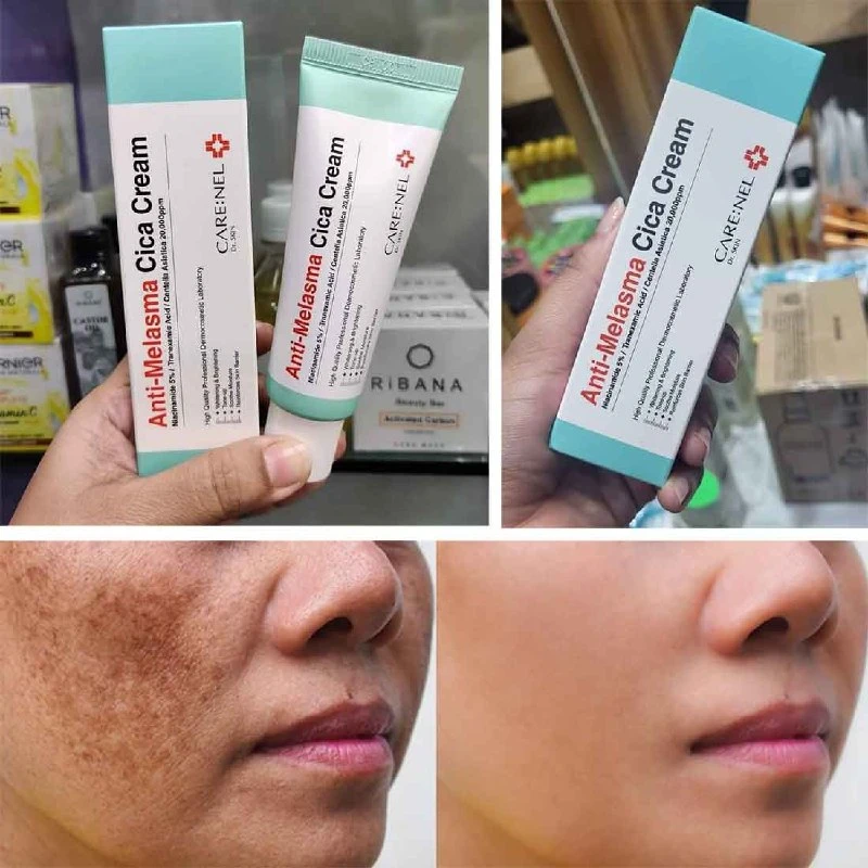 CARENEL Anti-Melasma Cica Cream 40ml | Korea